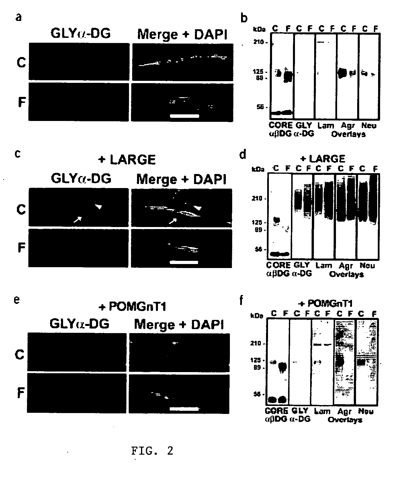 Increasing functional glycosylation of alpha-dystroglycan in the treatment of muscle degeneration