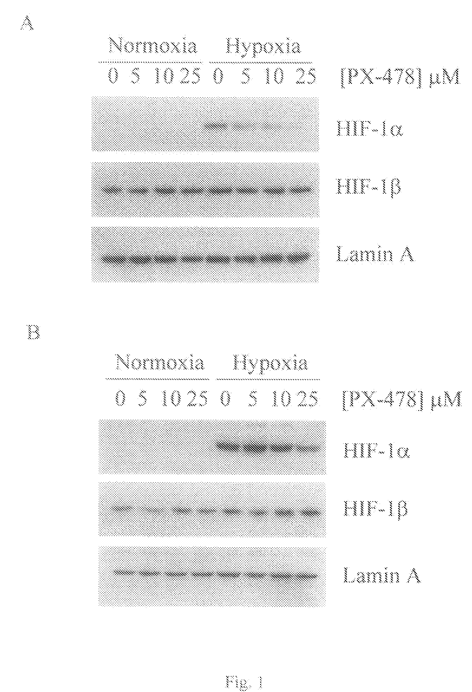 Methods of identifying respondents to hypoxia inducible factor 1-alpha inhibitors