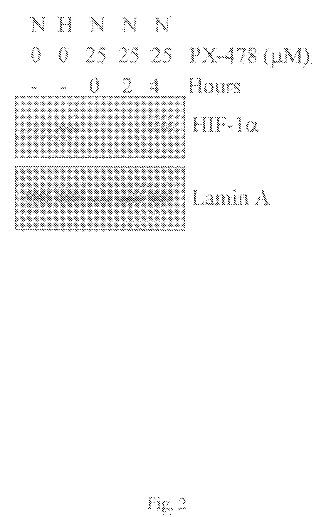 Methods of identifying respondents to hypoxia inducible factor 1-alpha inhibitors