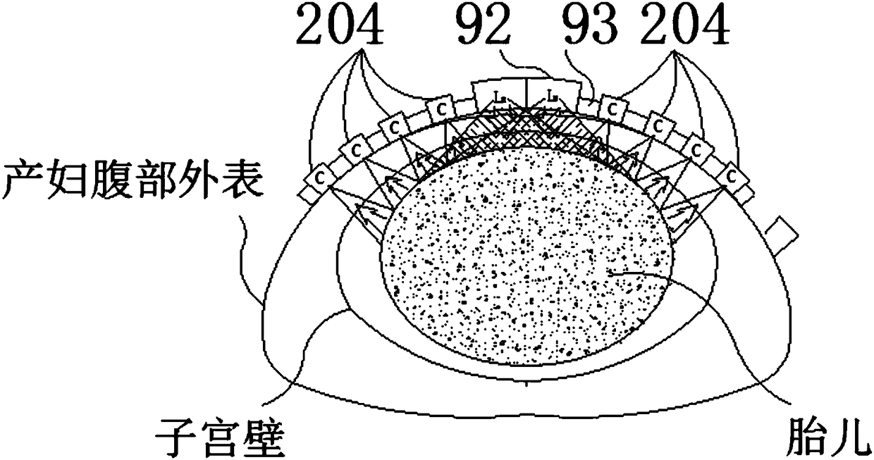 Luminous source device and fetal blood oxygen light signal acquisition device