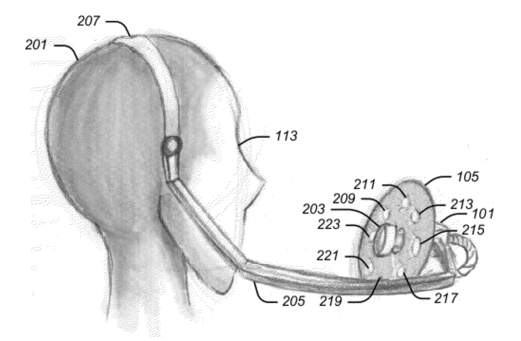 Head-Mounted Photometric Facial Performance Capture