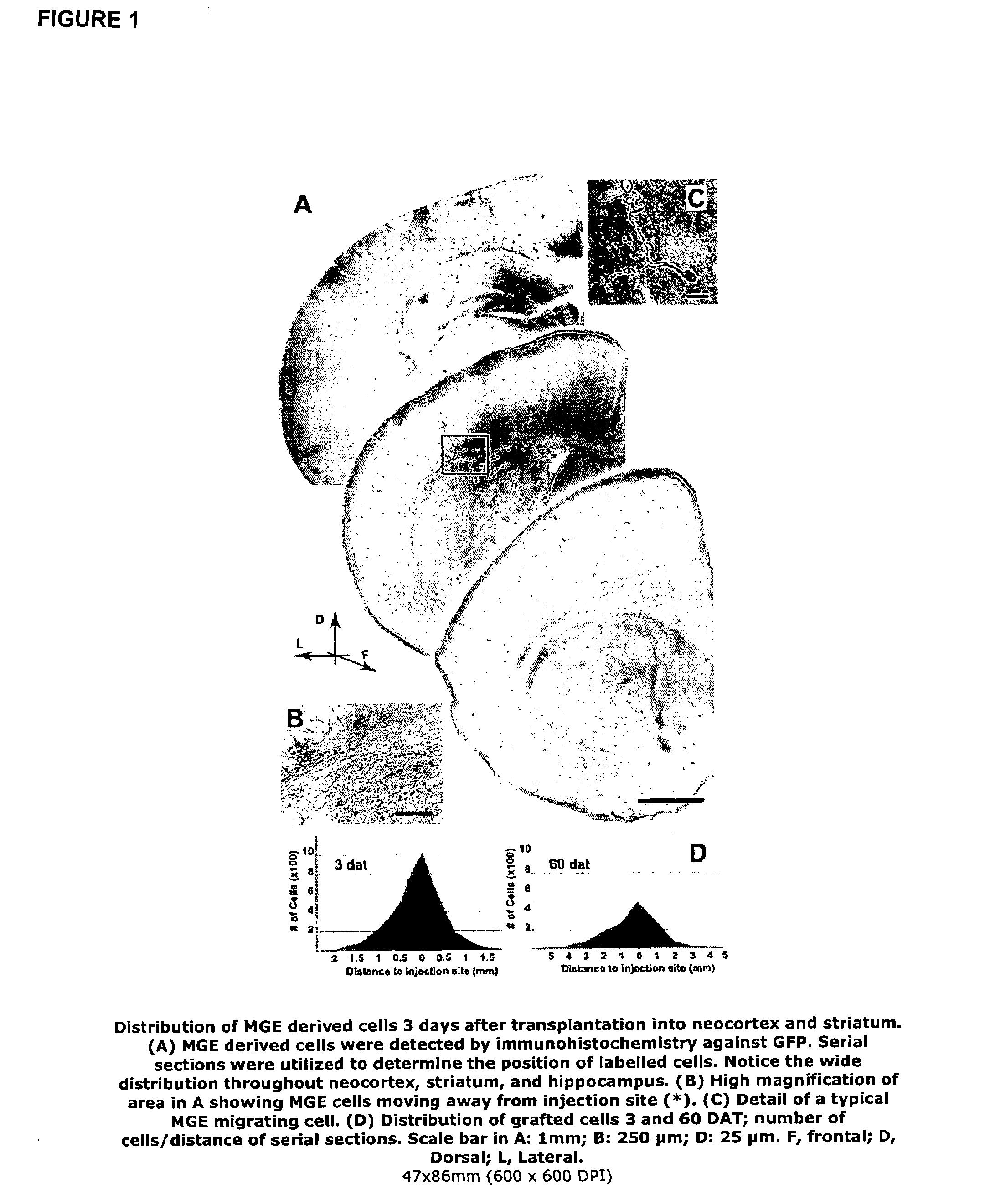 Transplantation of neural cells