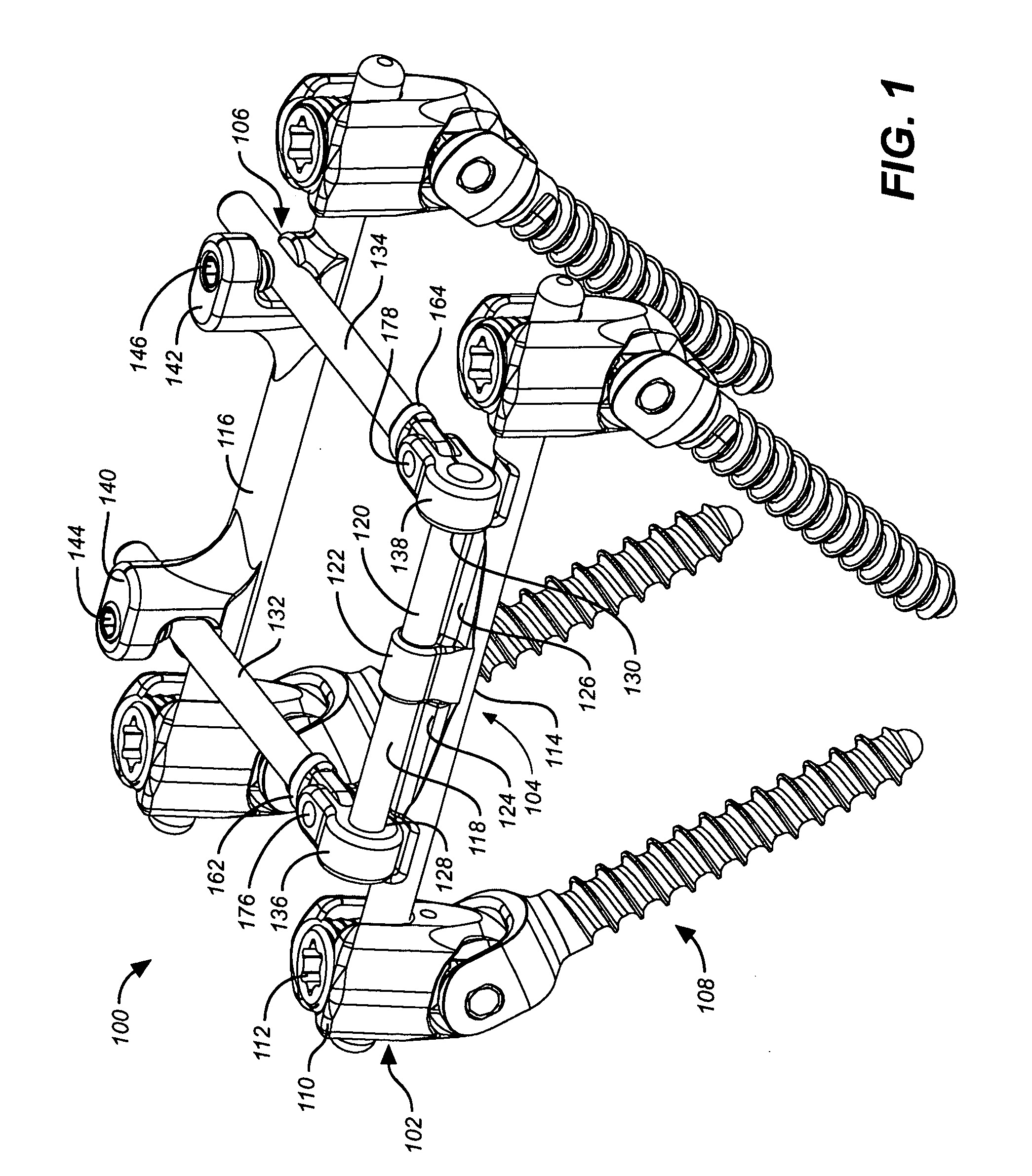 Dynamic stabilization and motion preservation spinal implantation system with a shielded deflection rod system and method