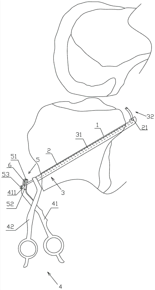 A special tibial tunnel passing wire traction push-pull device for orthopedic surgery