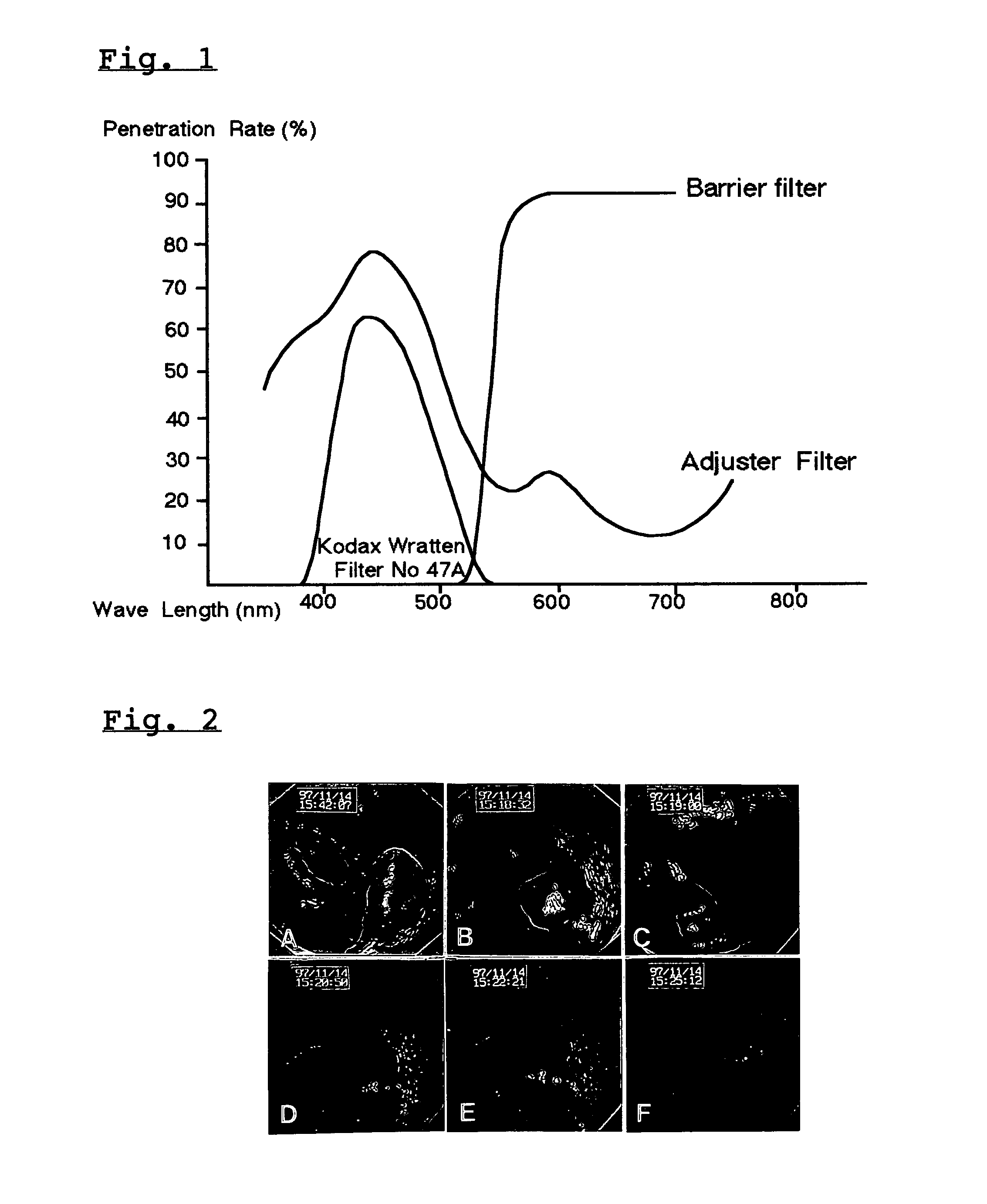 Fluorescence electronic endoscopic system