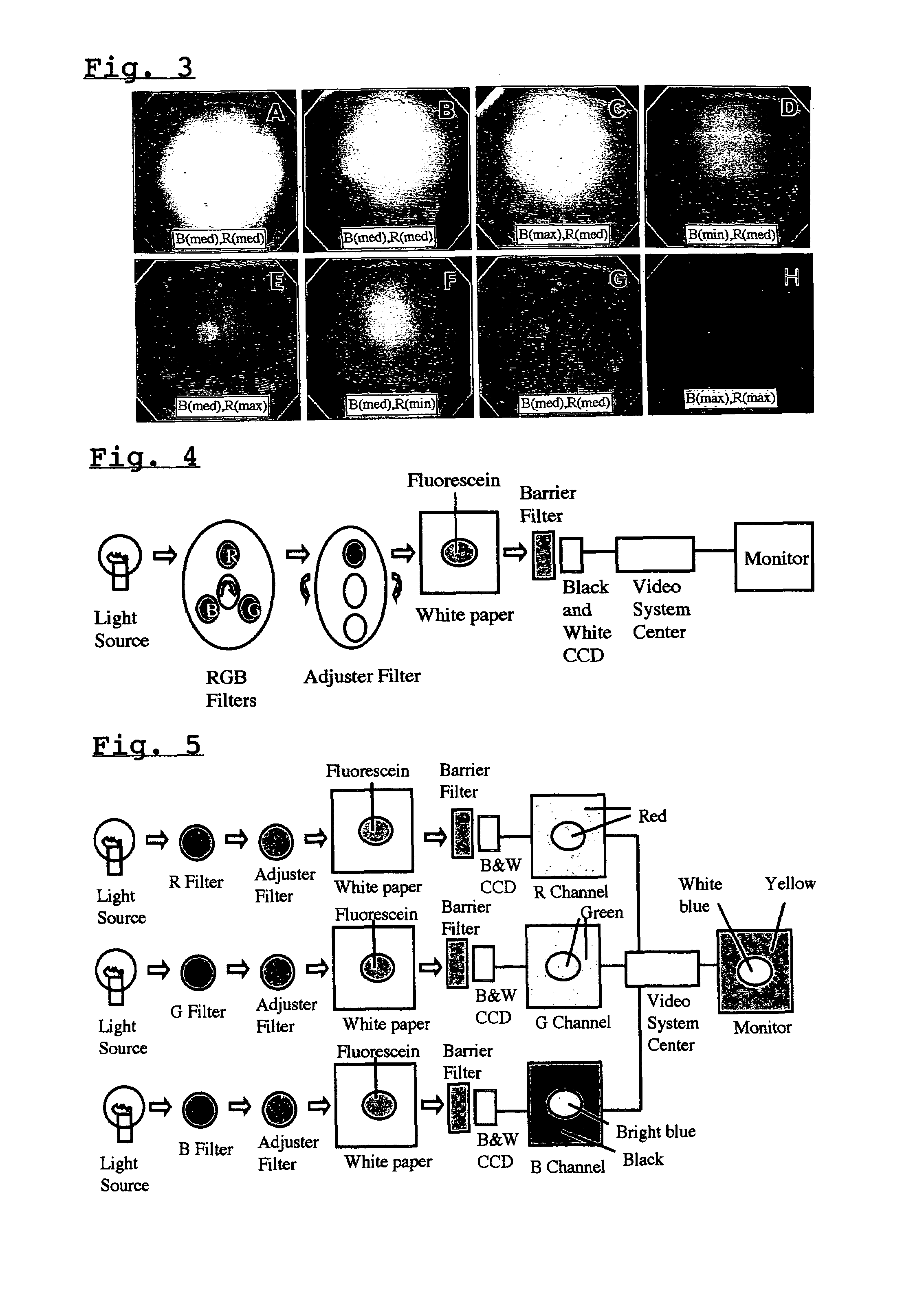 Fluorescence electronic endoscopic system