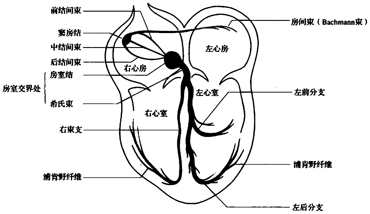 Heart beat classification method and device for multi-label labeling of electrocardiosignals