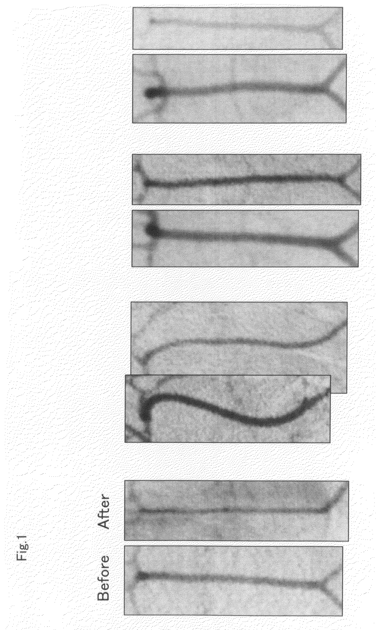 Cerebral Vasospasm Inhibitor