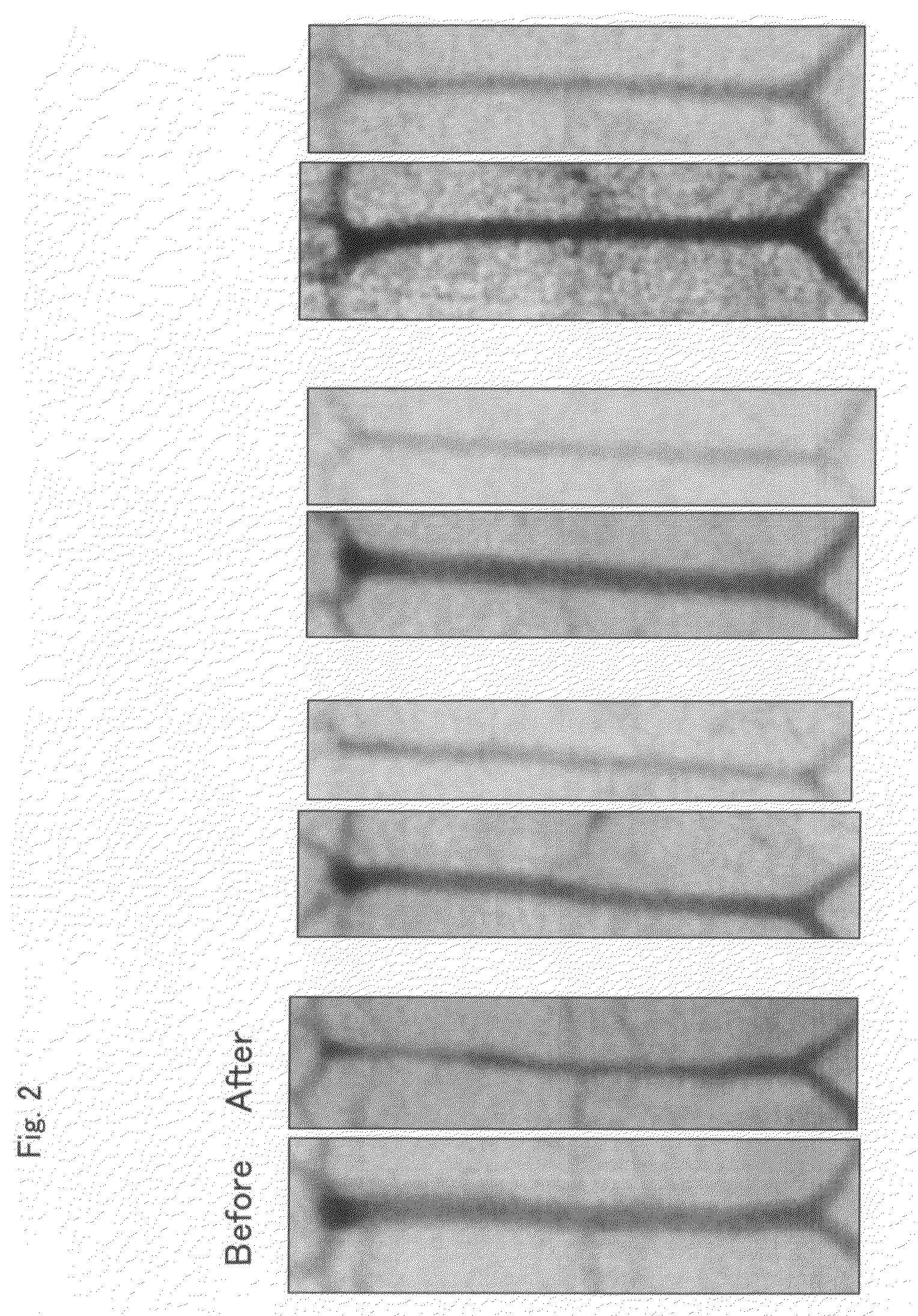 Cerebral Vasospasm Inhibitor