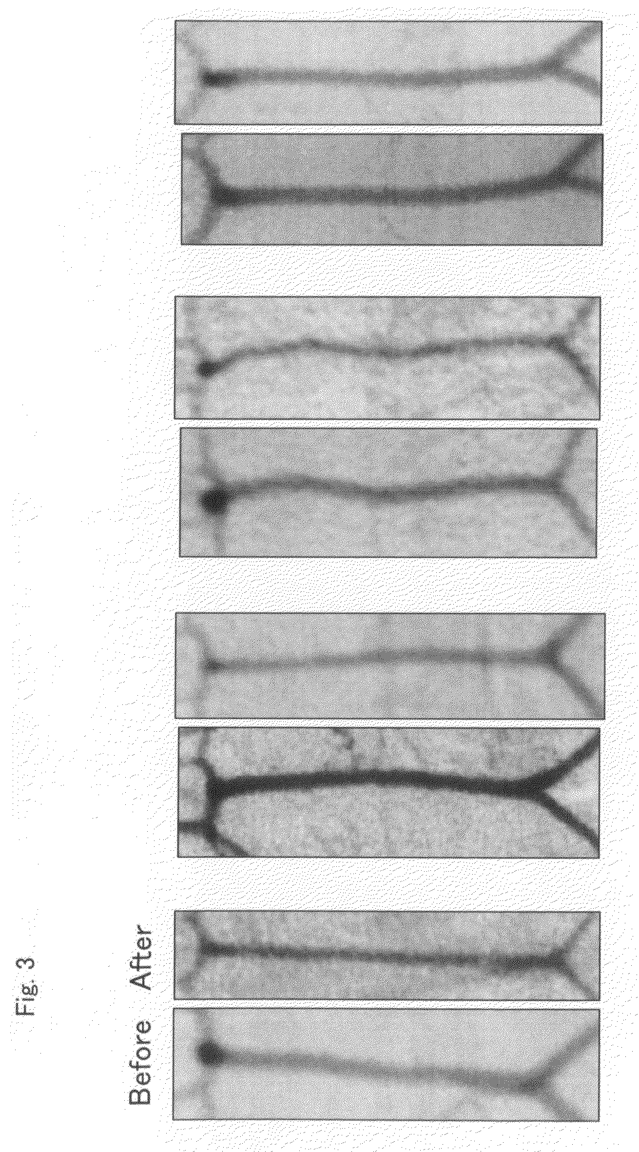 Cerebral Vasospasm Inhibitor