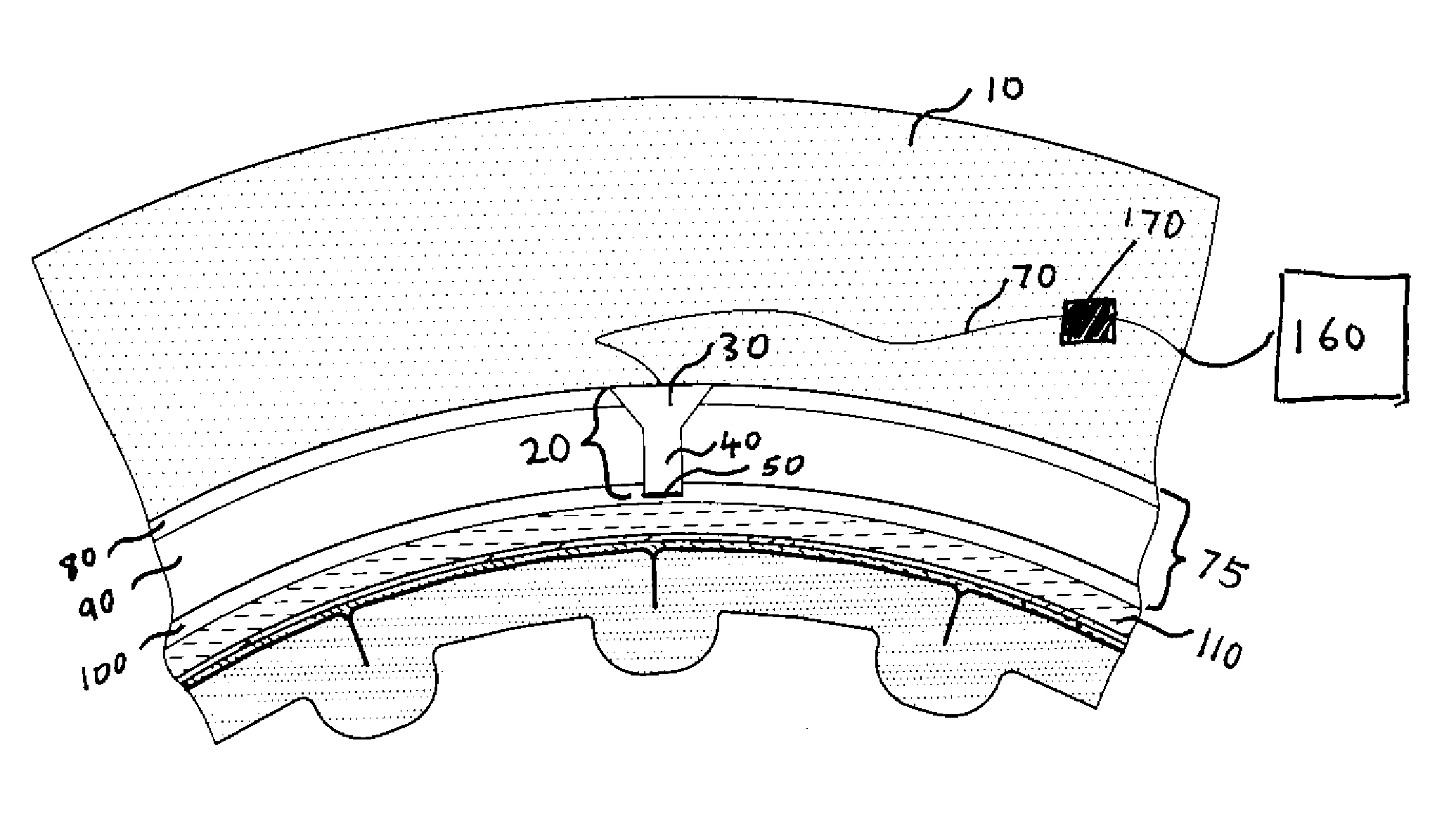 Methods and systems for using intracranial electrodes