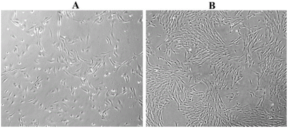 A directional differentiation induction method of human embryonic stem cells to obtain corneal endothelial cells