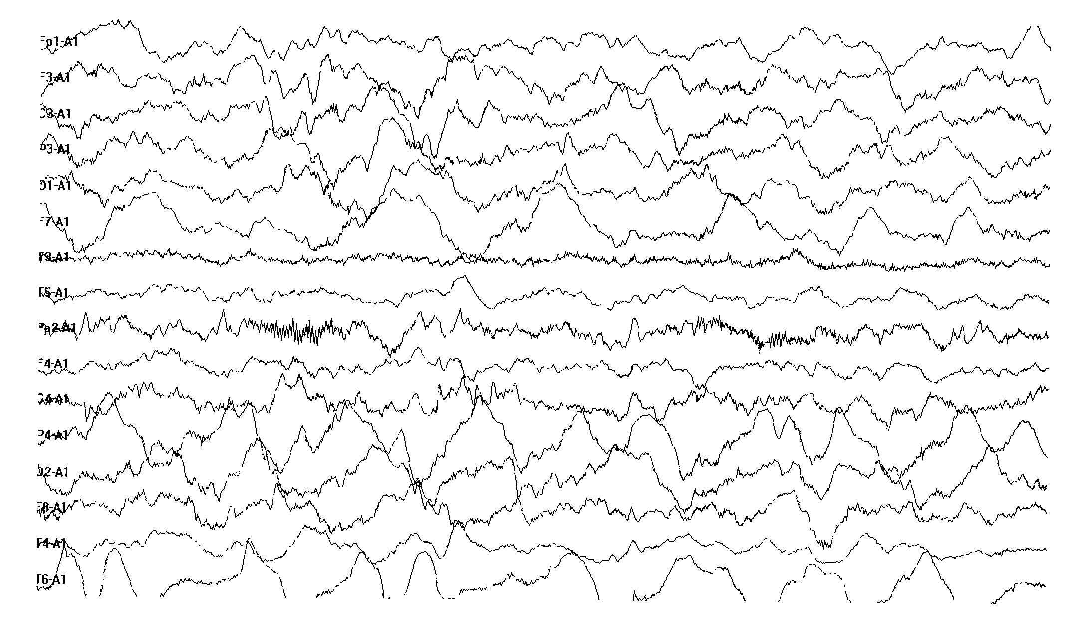 Method for making epileptic seizure animal model