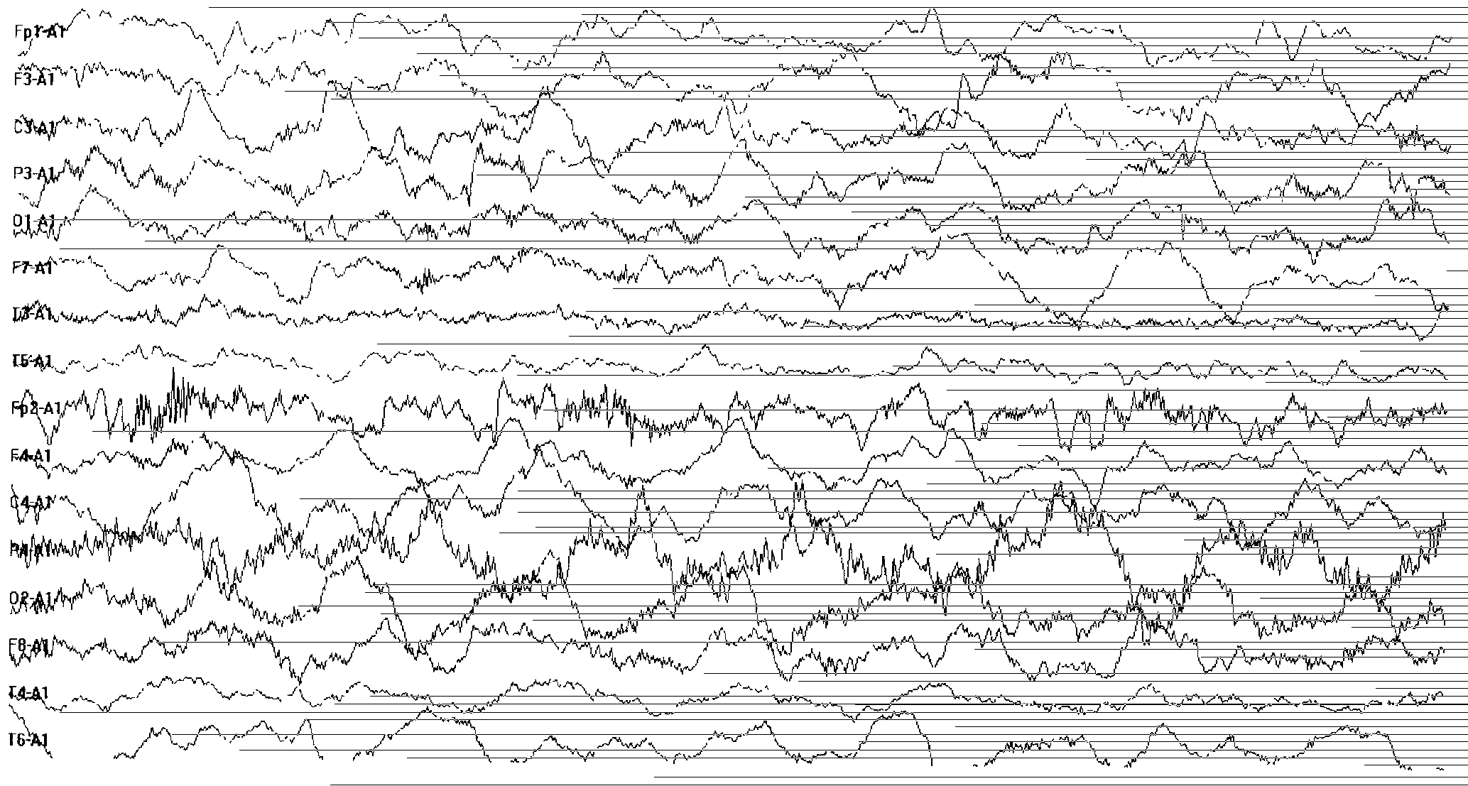 Method for making epileptic seizure animal model