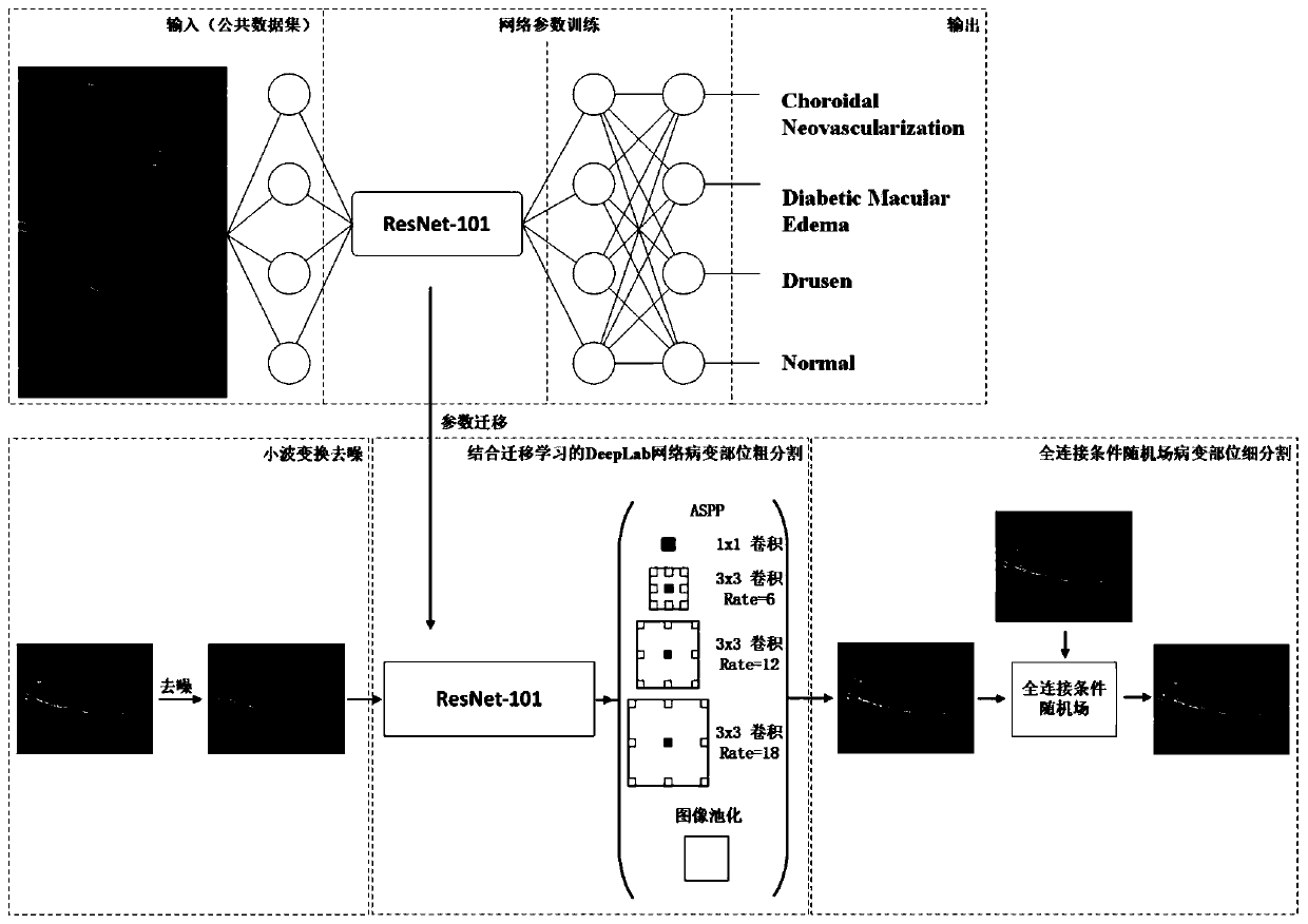 Improved DME edema area neural network segmentation model construction method