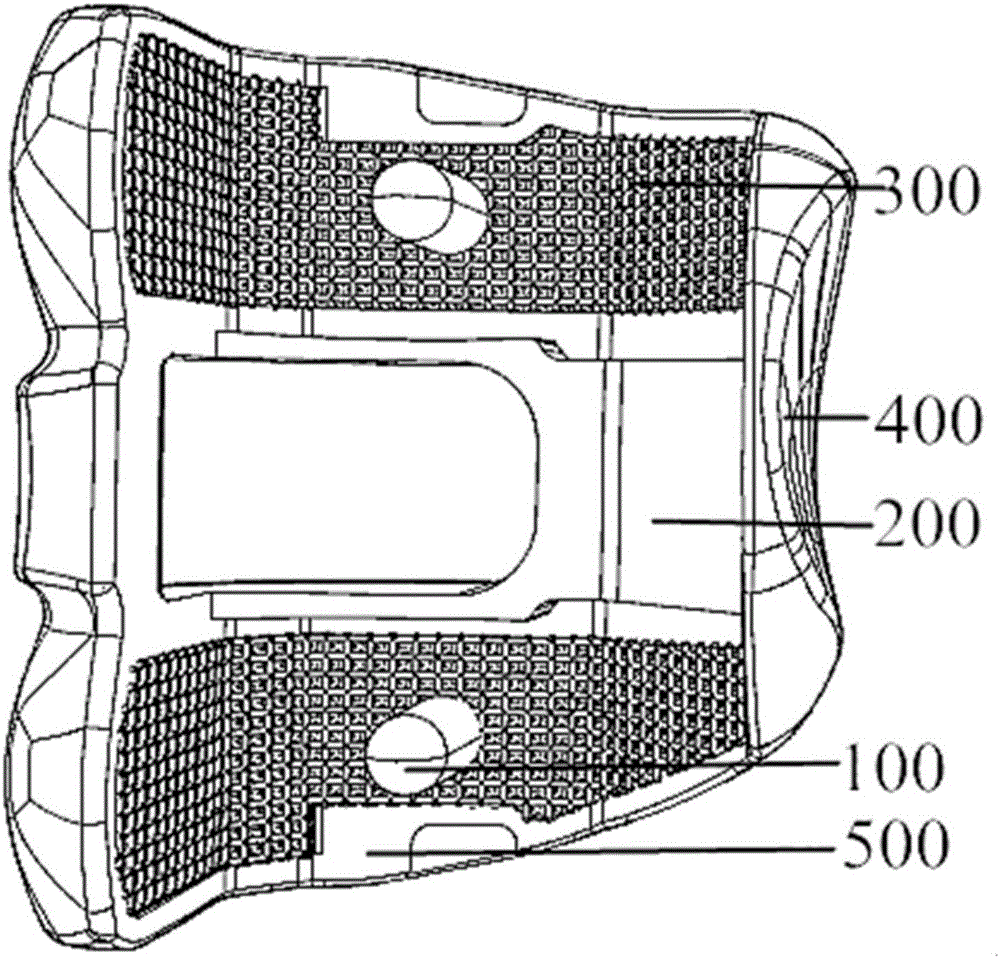 Personalized femoral prosthesis and manufacturing method