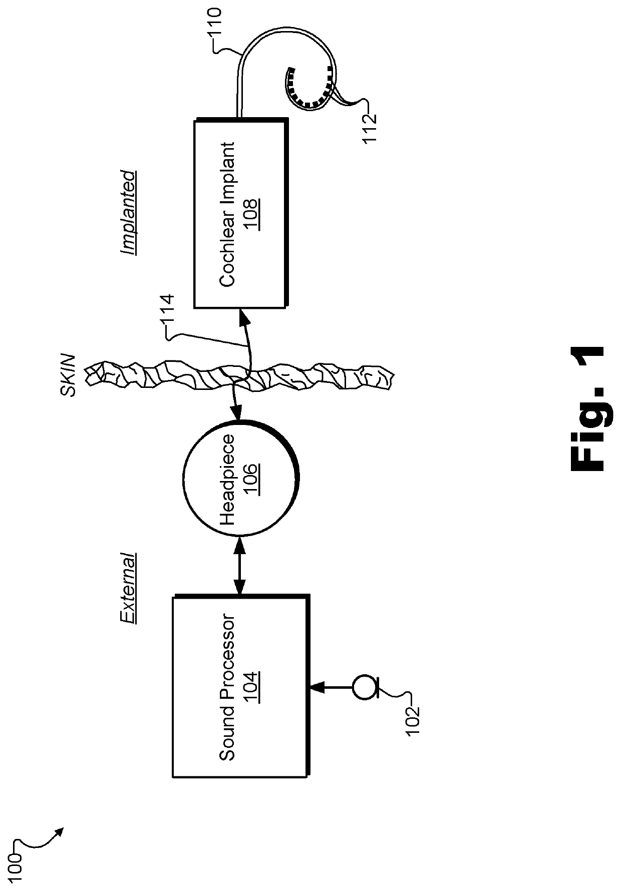 Apparatuses and methods for setting cochlear implant system stimulation parameters based on electrode impedance measurements