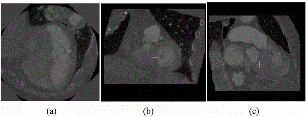 Heart multi-plane reconstruction method