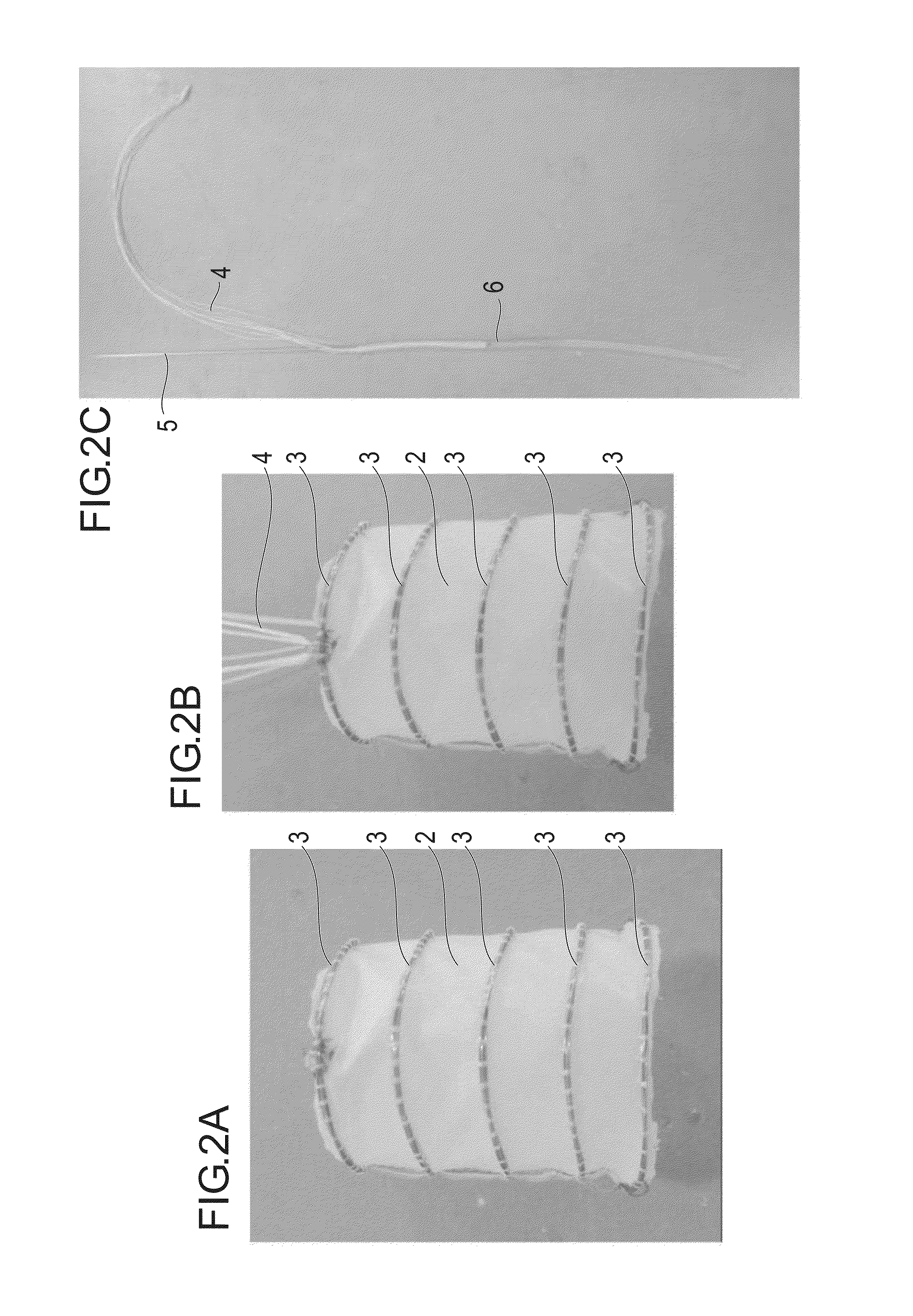 Body lumen graft base, production method of body lumen graft base, and body lumen graft using the same