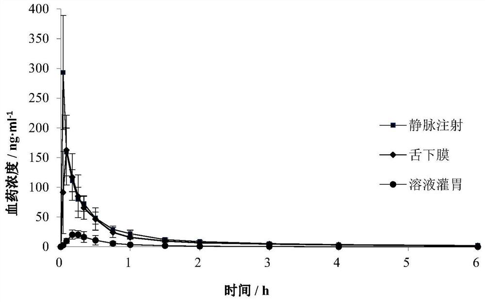 Rasagiline or medicinal salt sublingual film agent thereof as well as preparation method and application thereof