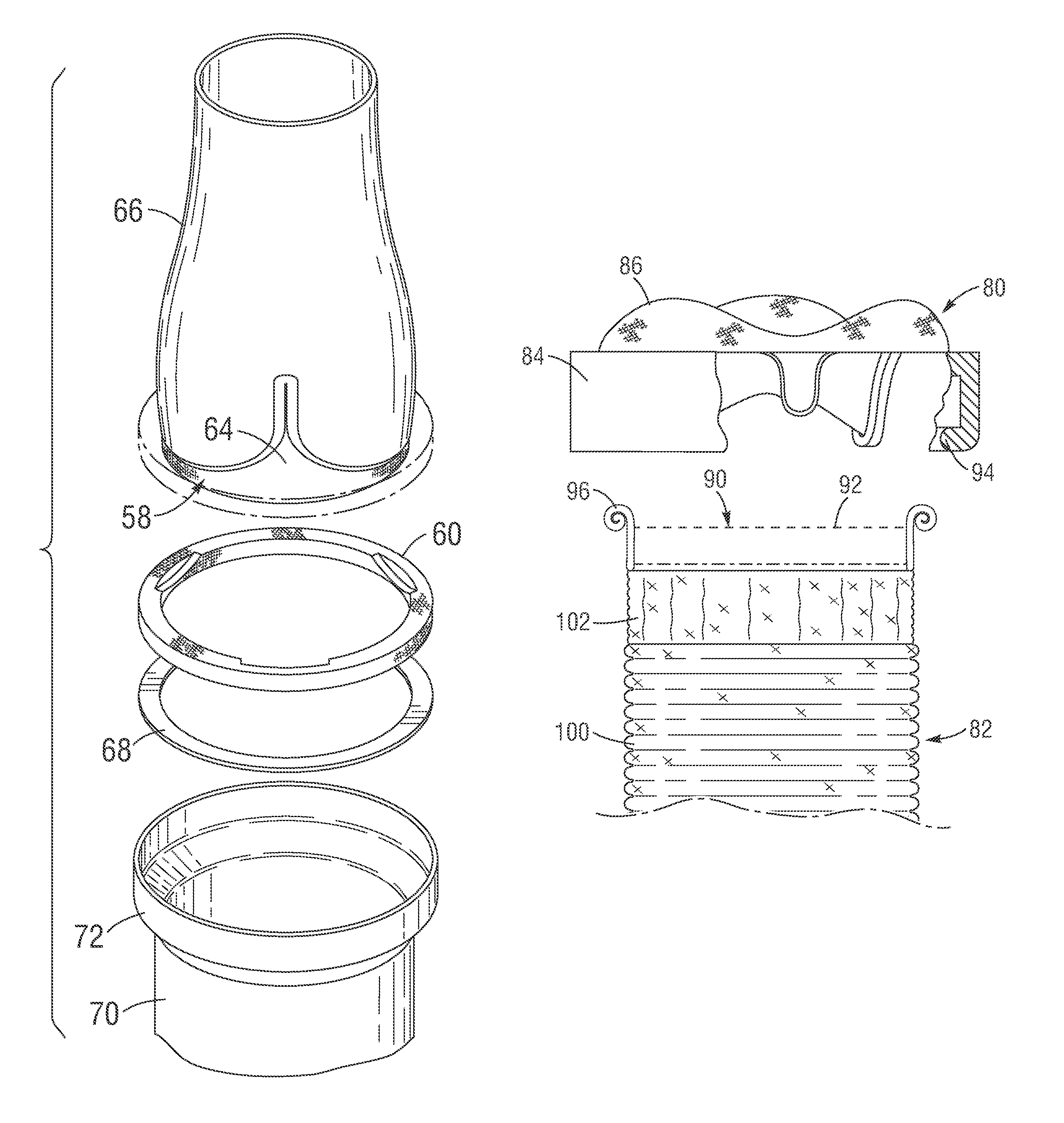 Pre-assembled bioprosthetic valve and sealed conduit