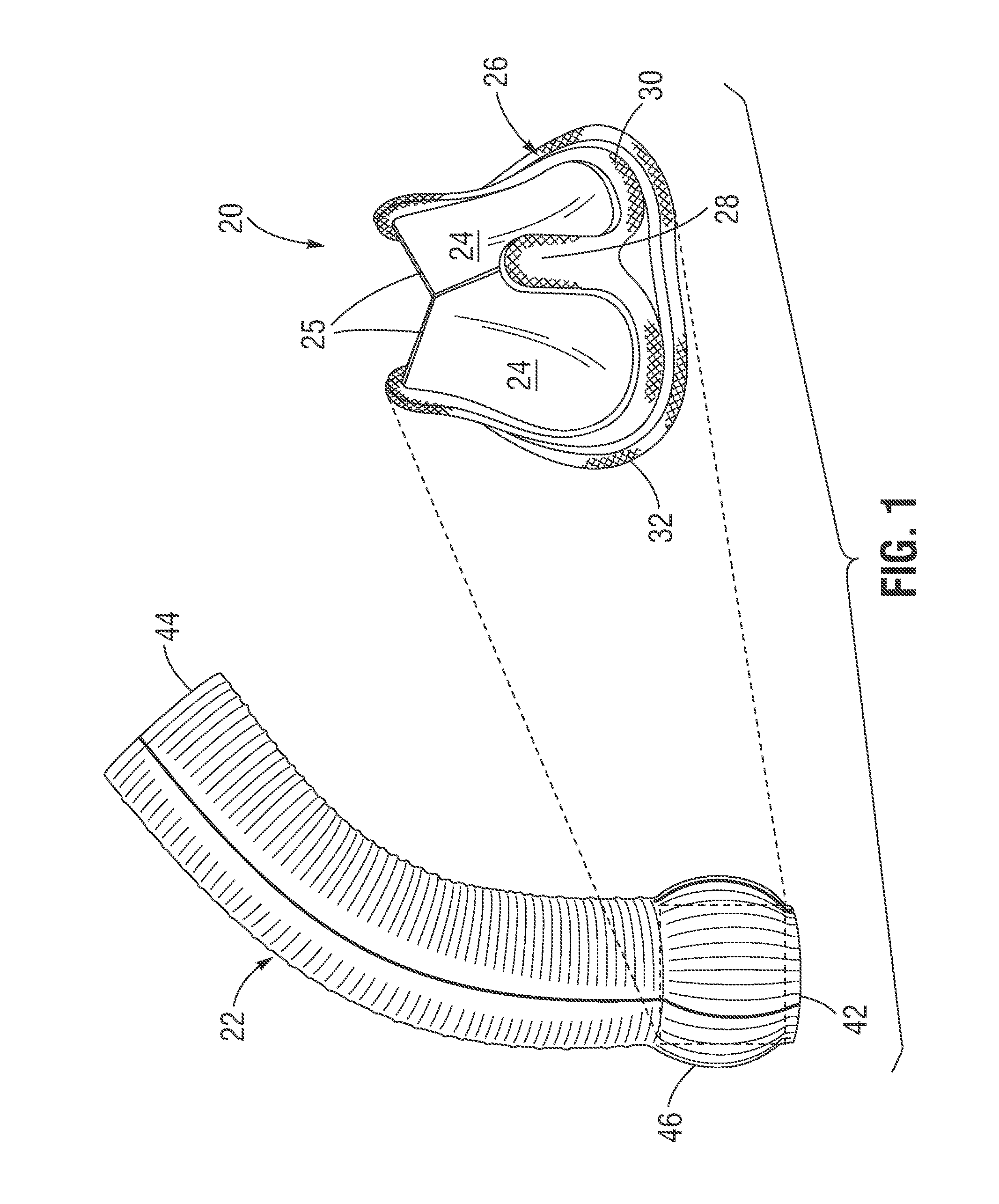 Pre-assembled bioprosthetic valve and sealed conduit