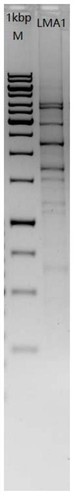 Human-derived lactobacillus mucosae and application thereof