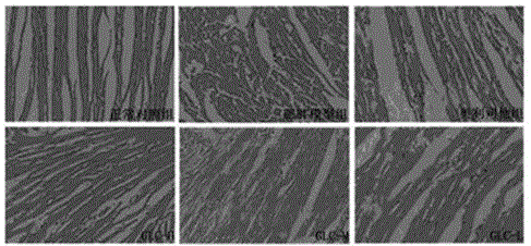 Application of glucosamine in weight reduction and fat reduction