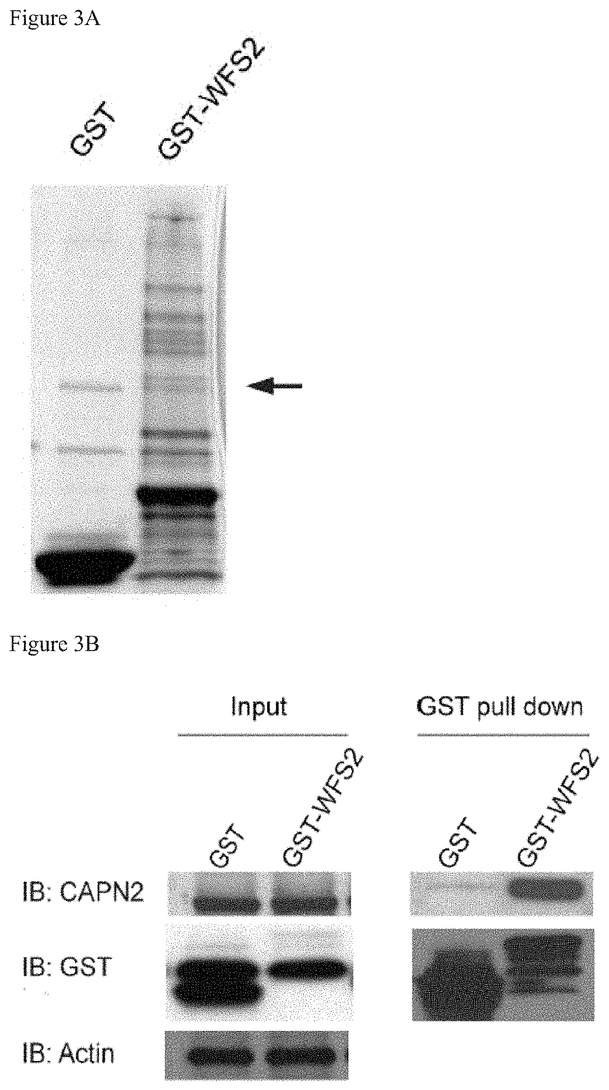 Treatment for wolfram syndrome and other endoplasmic reticulum stress disorders