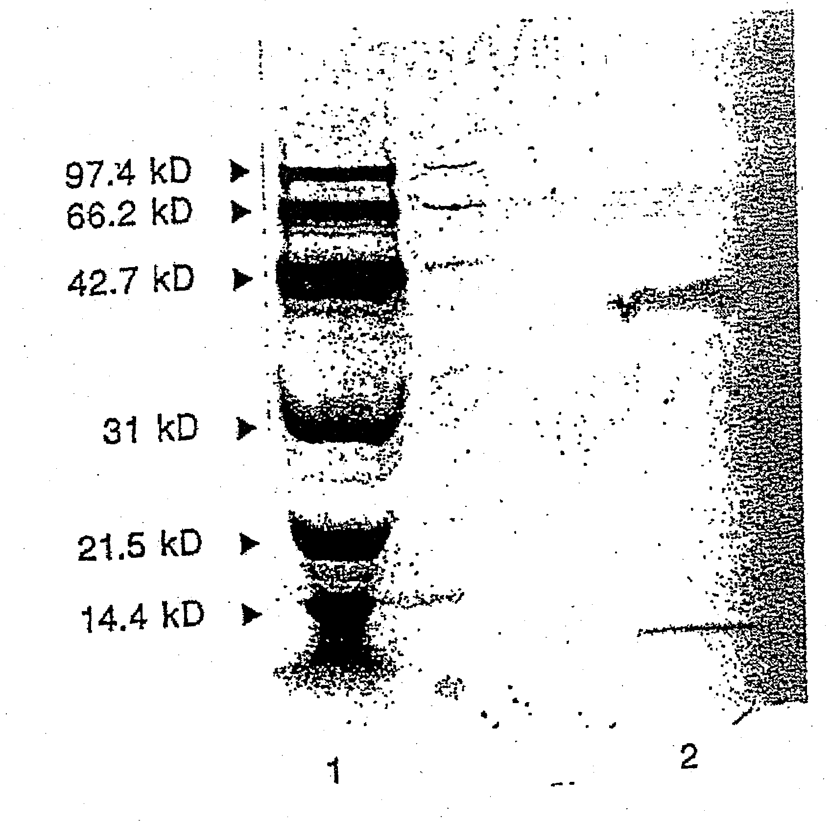 Therapeutic uses of glandular kallikrein