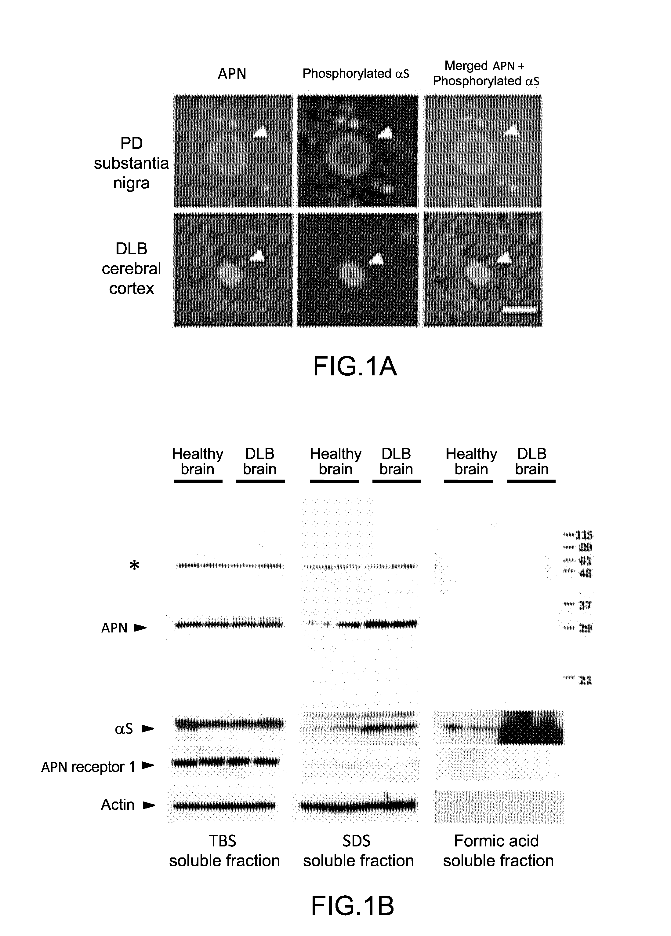 Method for treating and/or preventing neurodegenerative disease by adiponectin receptor agonist