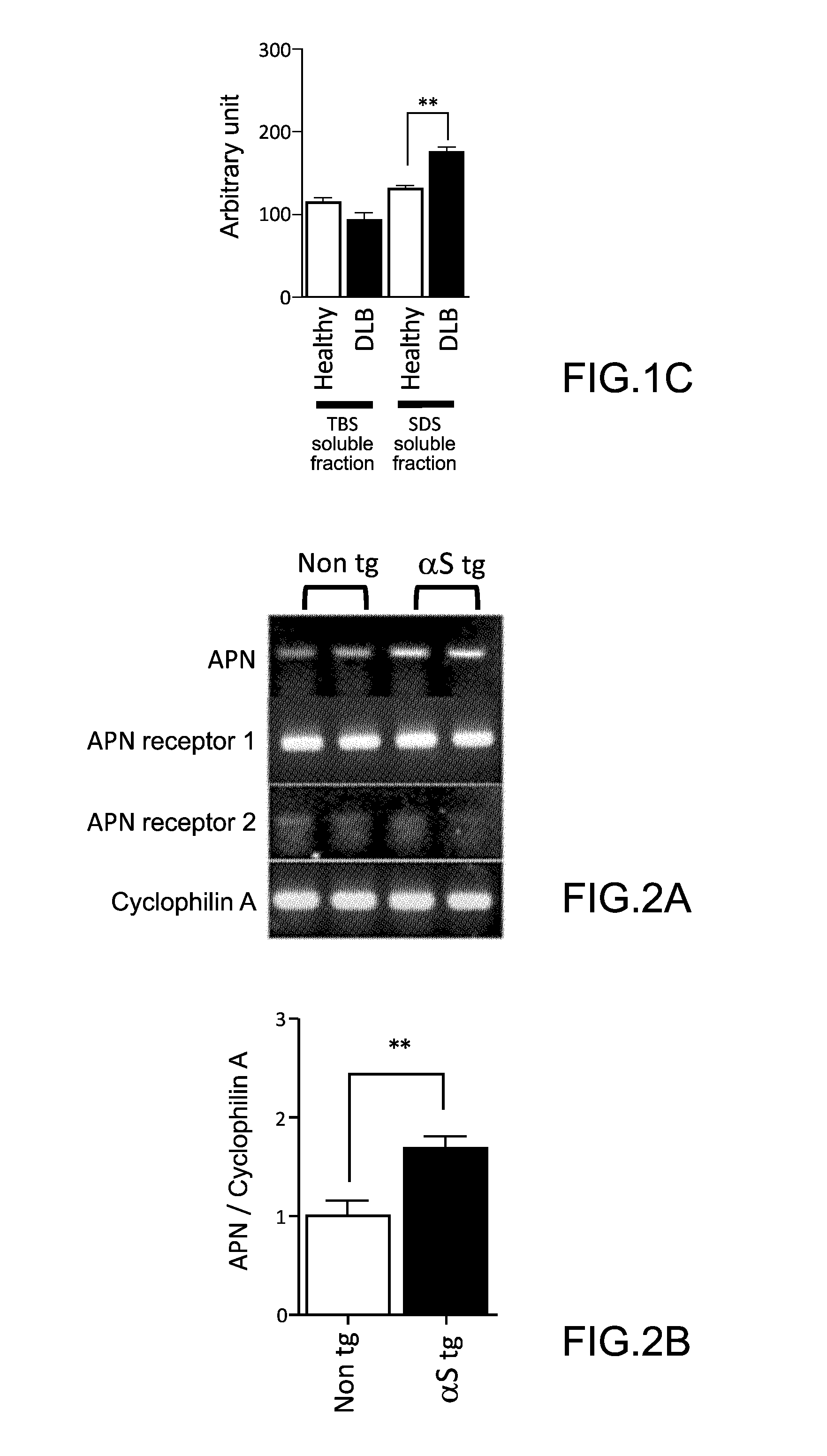 Method for treating and/or preventing neurodegenerative disease by adiponectin receptor agonist