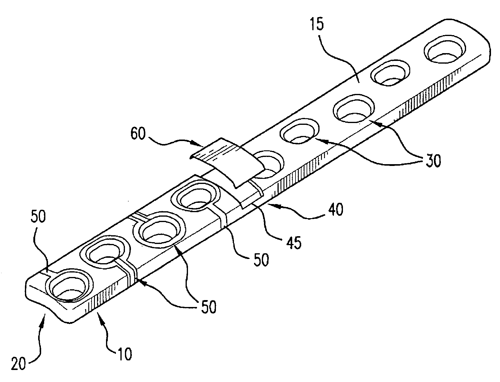 Orthopaedic implant with sensors