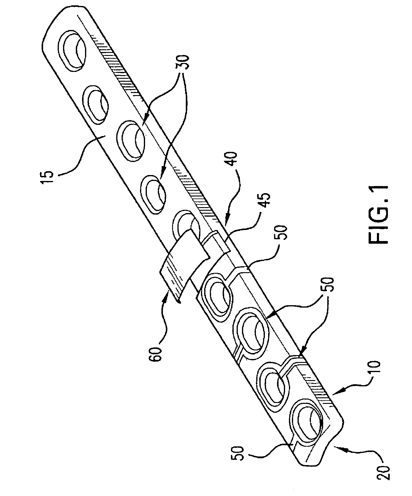 Orthopaedic implant with sensors