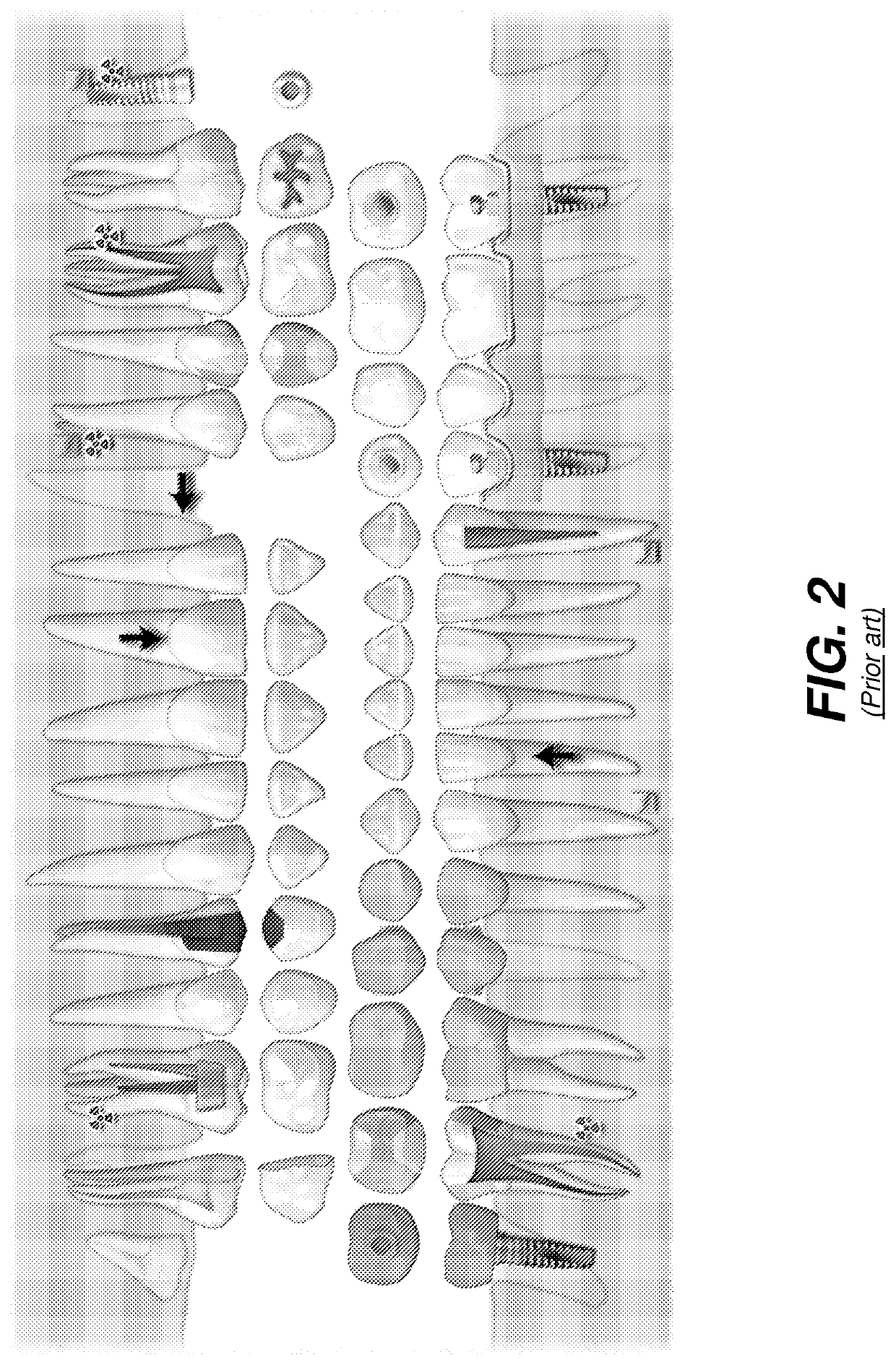 Dynamic dental arch map