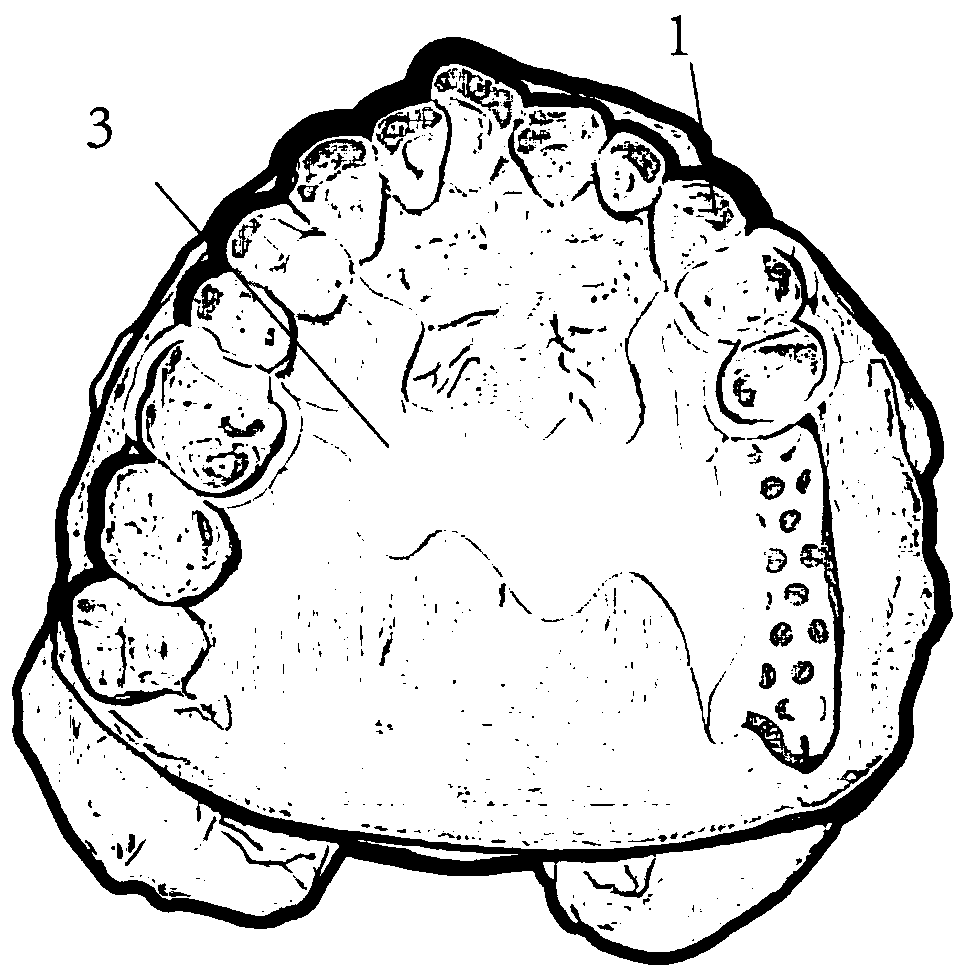 Intraoral restoration digital design method based on big data