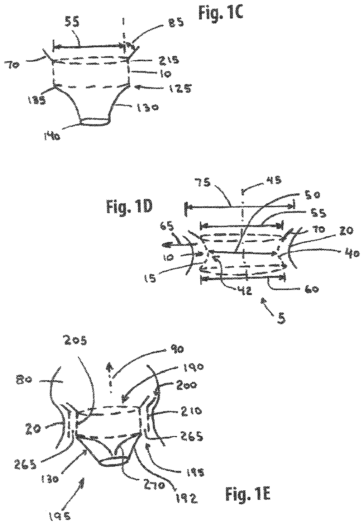 Annuloplasty device and methods