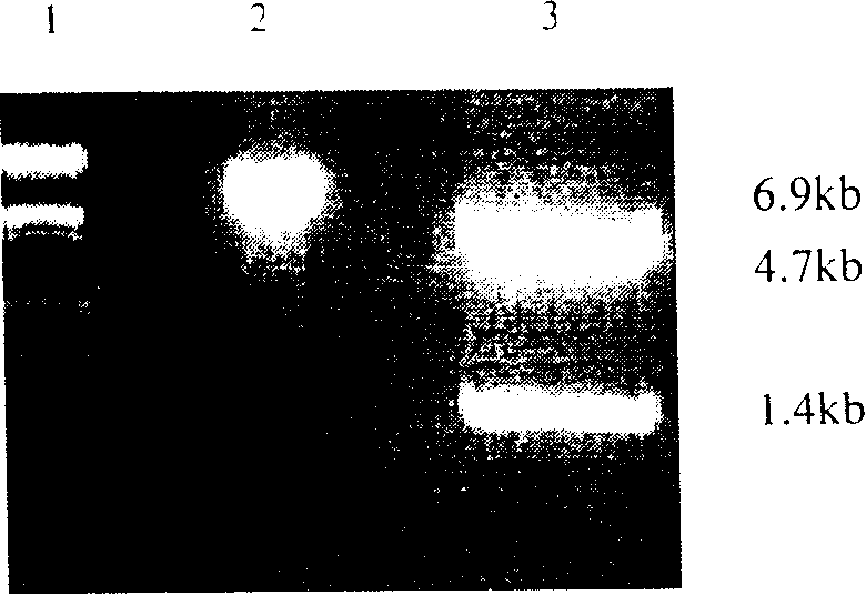 Retrovirus carrier of bone morphogenetic protein 4 gene and its use