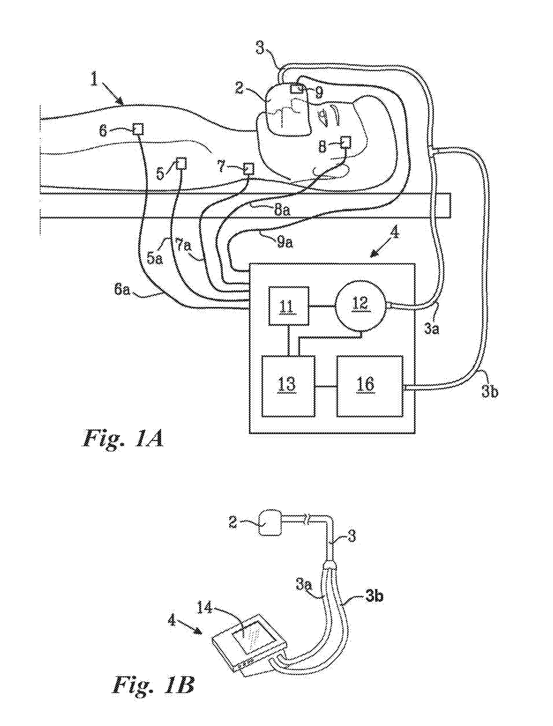 Flow sensor for ventilator