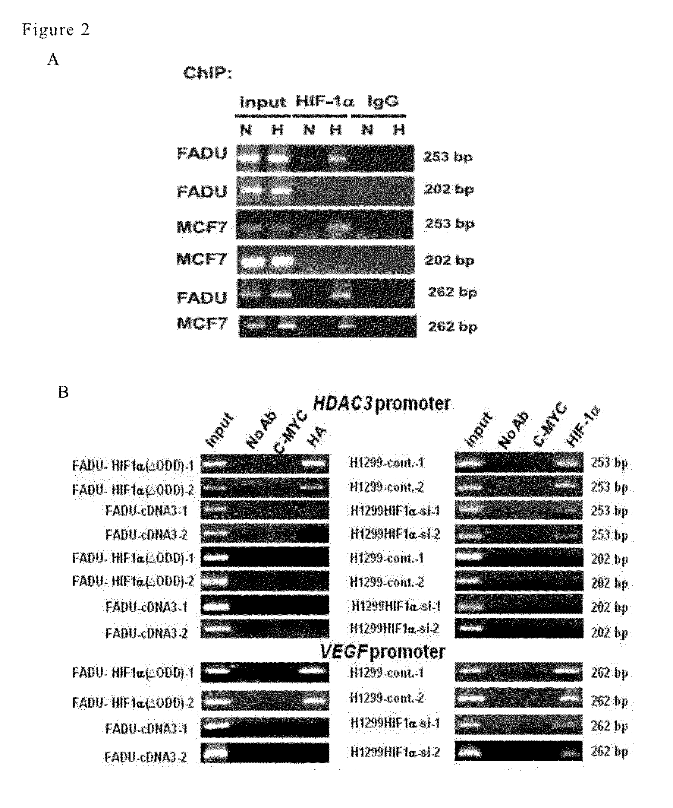 MARKER SET OF HIF-1alpha, HDAC3 AND WDR5 FOR PREDICTING METASTASIS AND SURVIVAL OF CANCERS