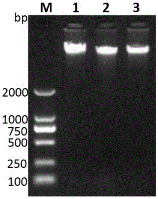 Liver abscess inducing Klebsiella pneumonia specific gene sequence and application thereof