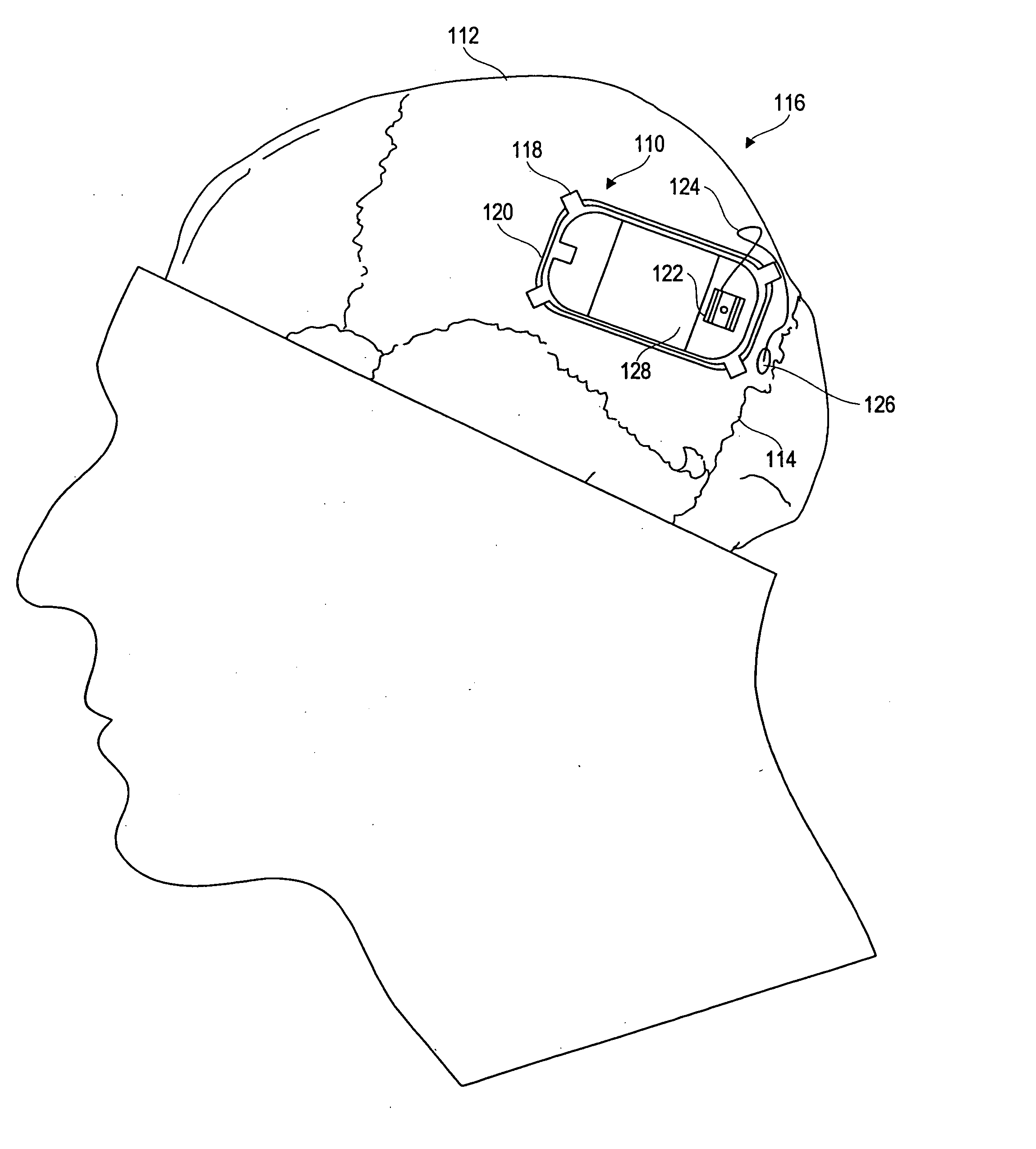 Differential neurostimulation therapy driven by physiological therapy