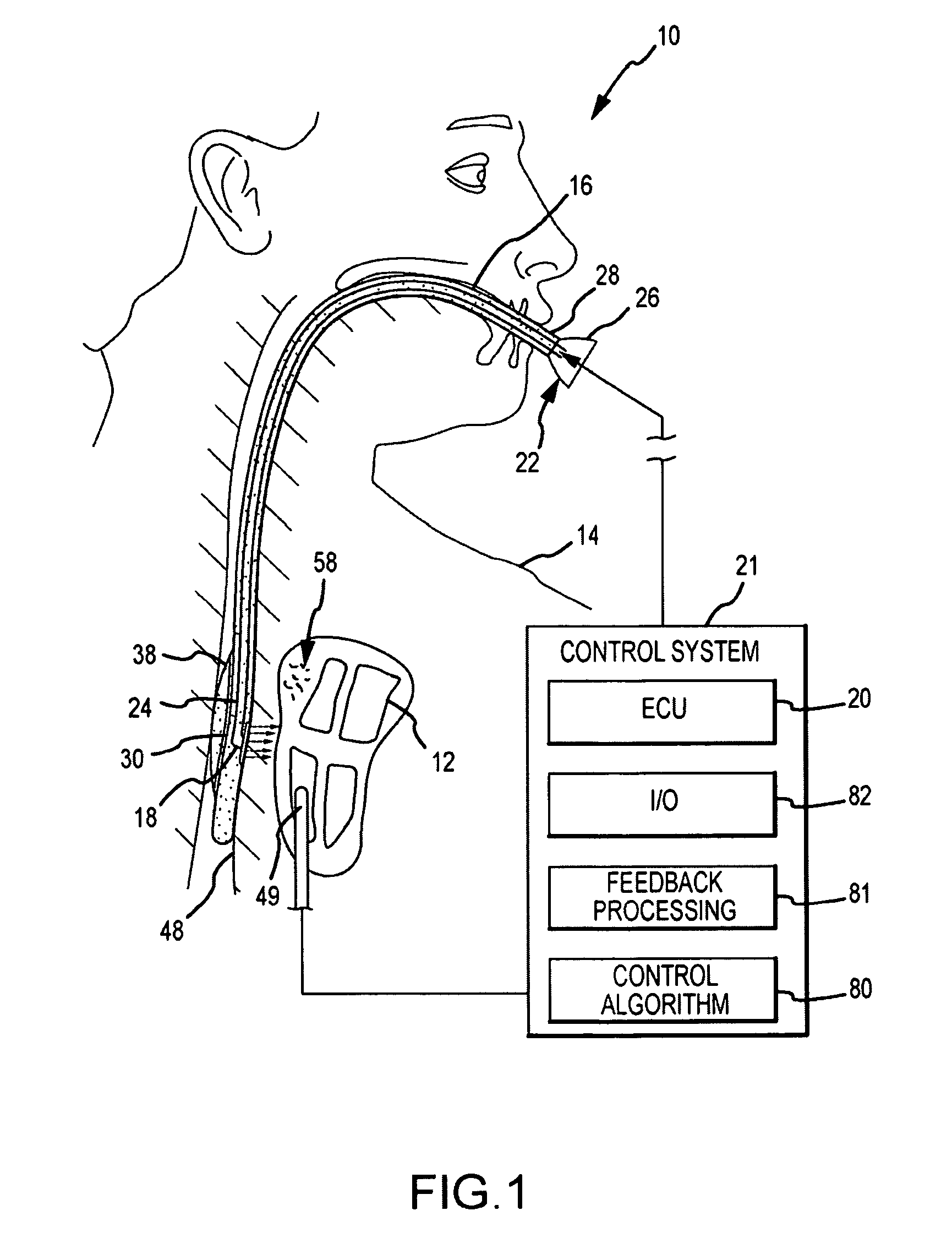 Systems and methods of photodynamic-based cardiac ablation via the esophagus