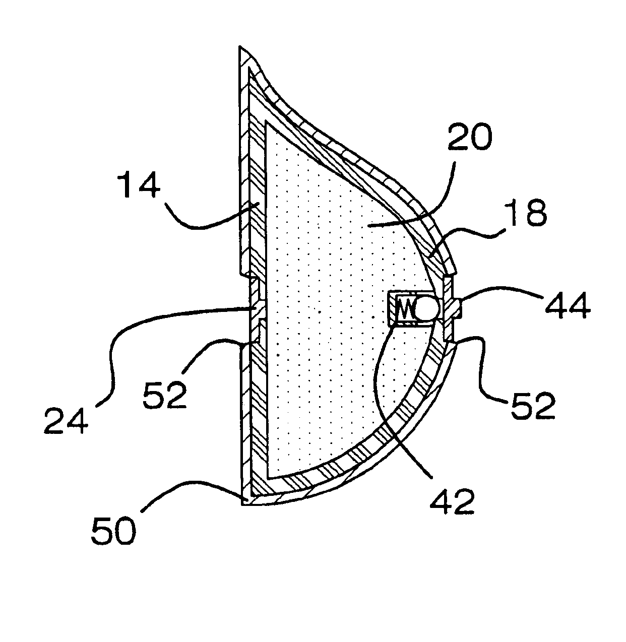 Inflatable prosthetic device