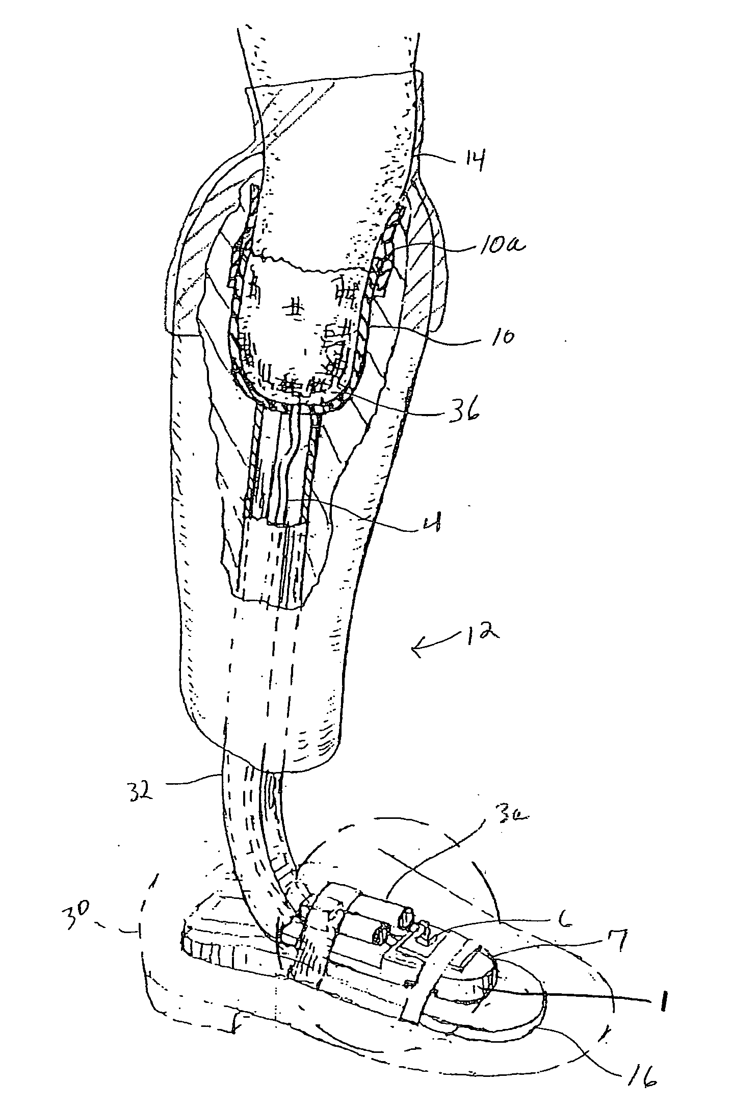 Prosthetic vacuum system