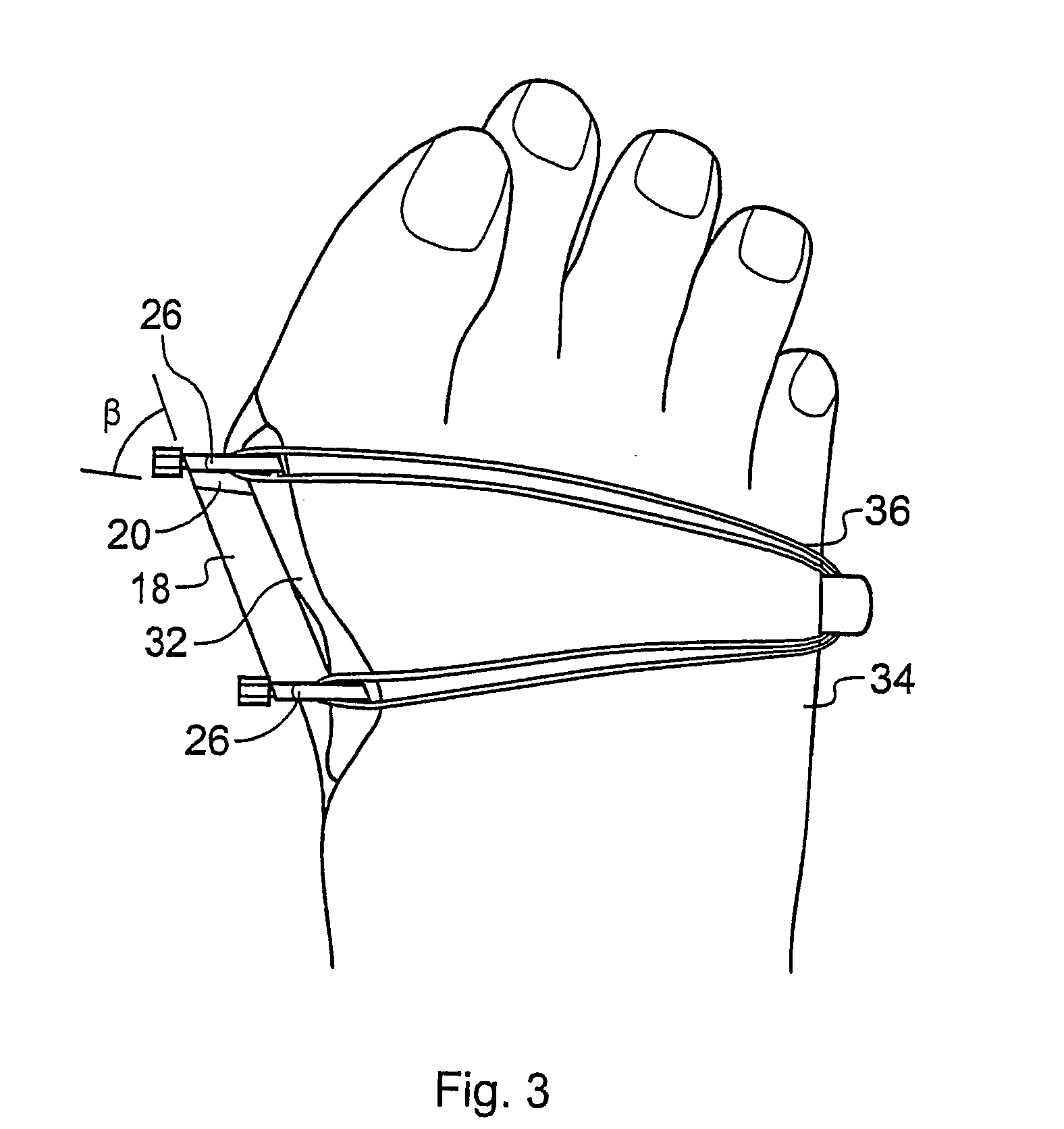 Surgical jig