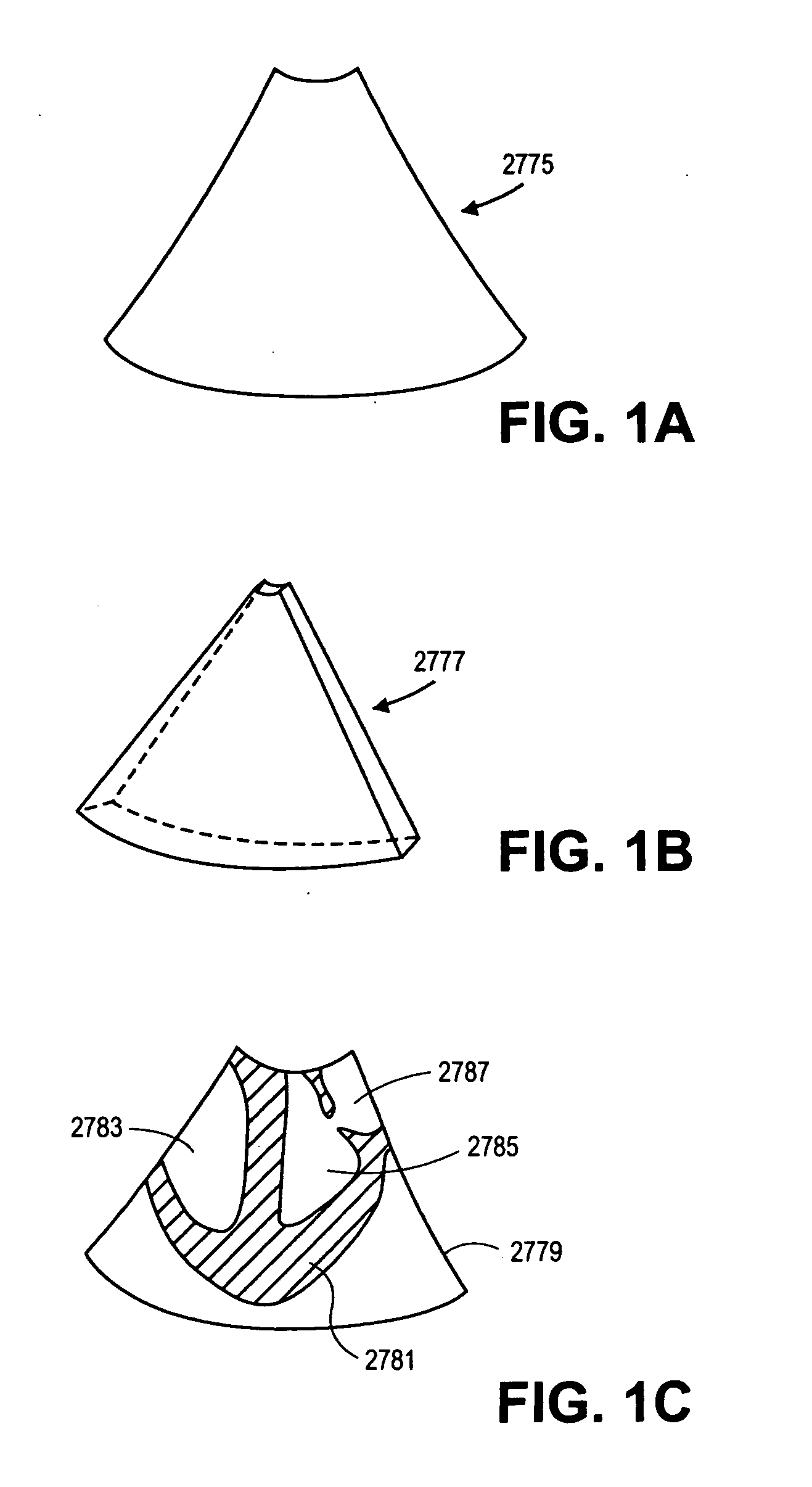 Methods and apparatuses for image guided medical procedures