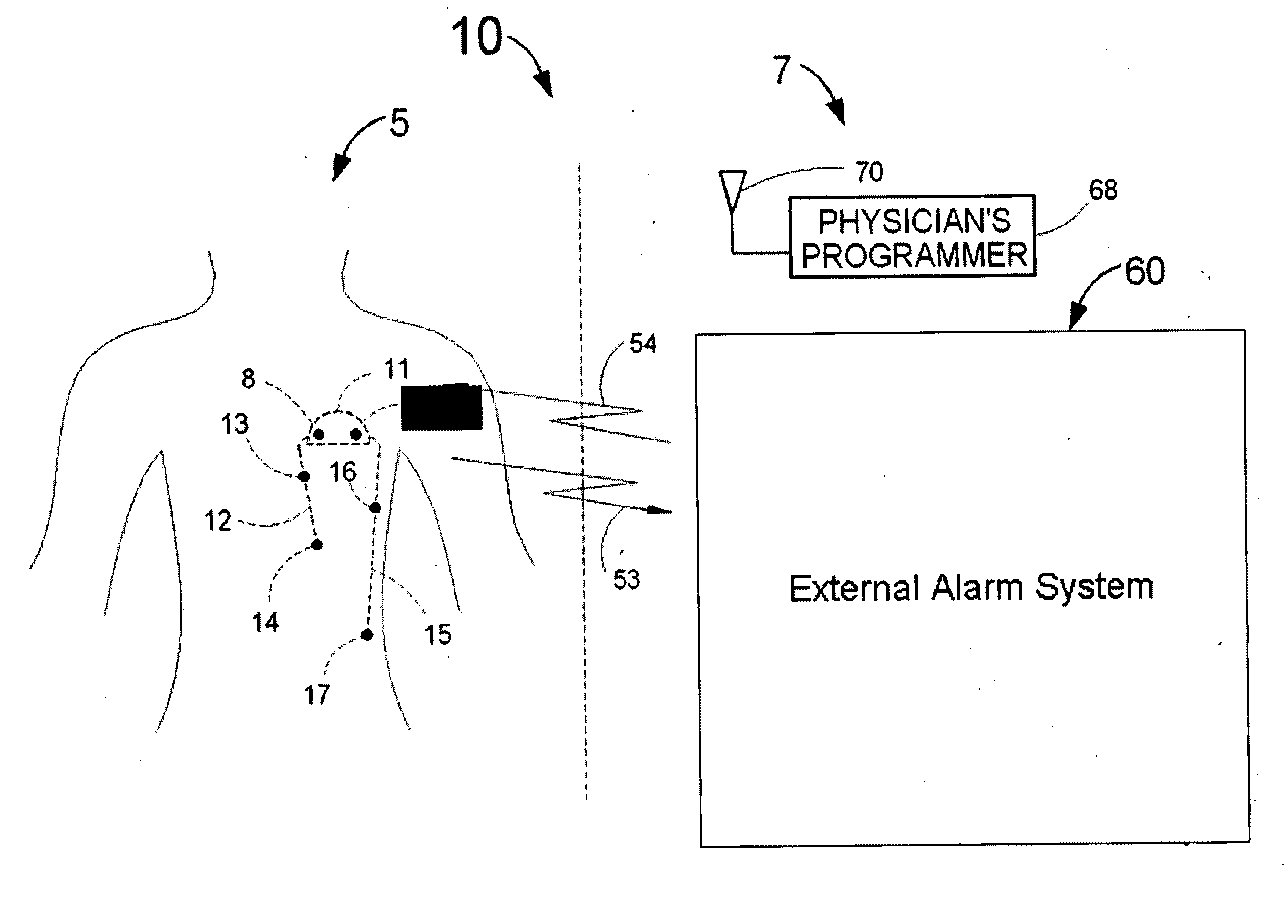 Header with integral antenna for implantable medical devices