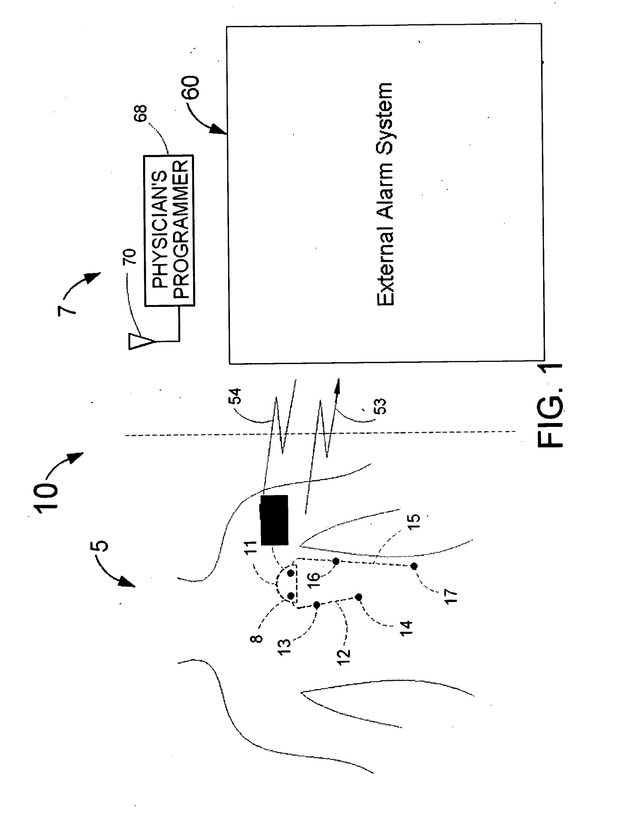 Header with integral antenna for implantable medical devices