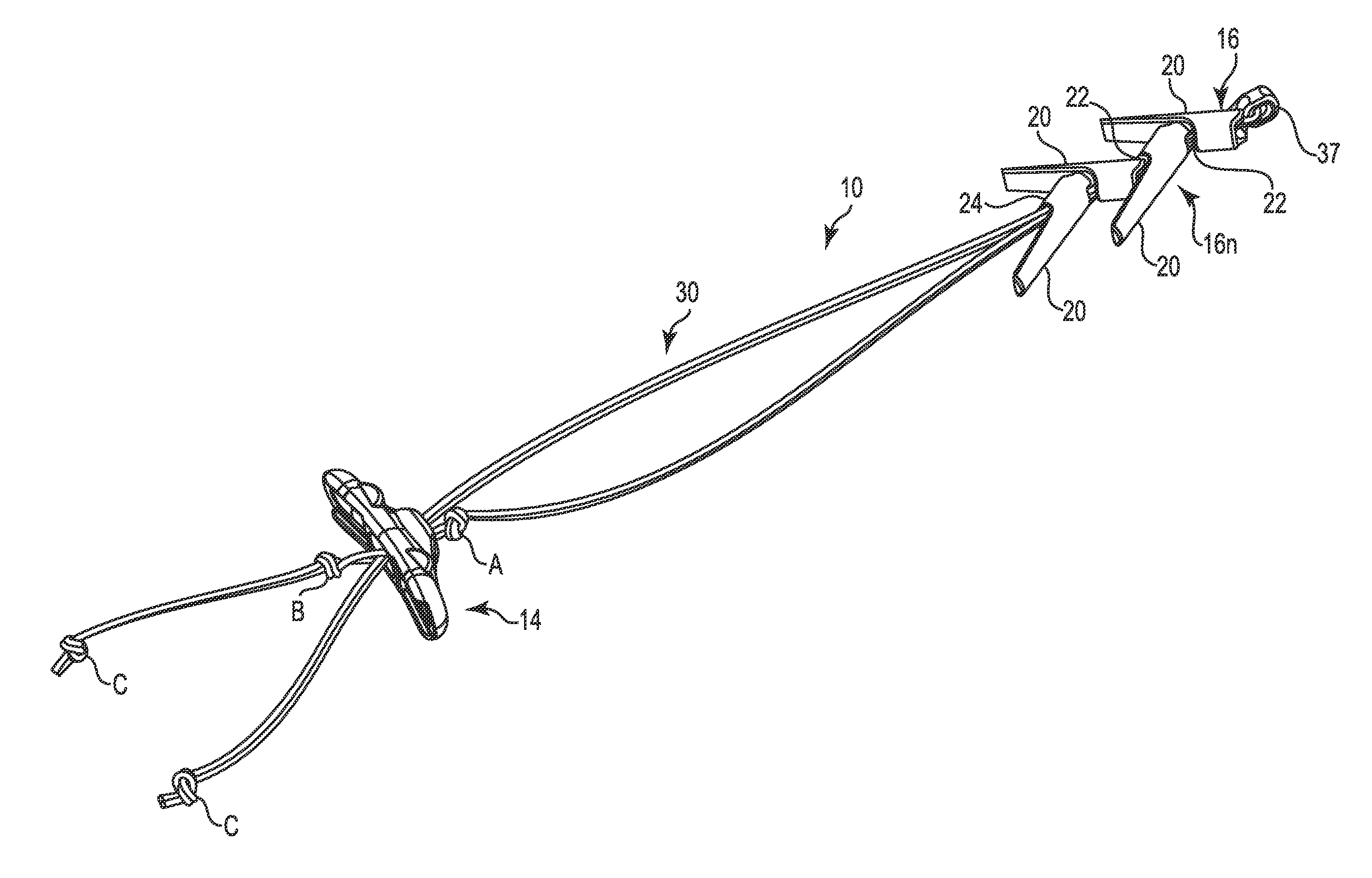 Surgical implant system and method